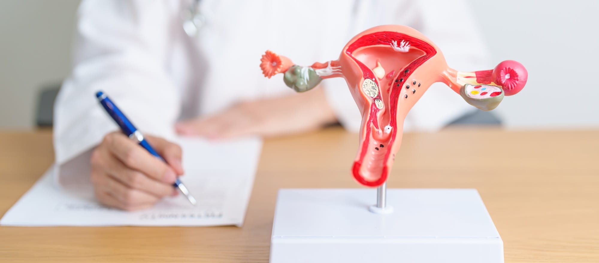Doctor with Uterus and Ovaries anatomy model.
