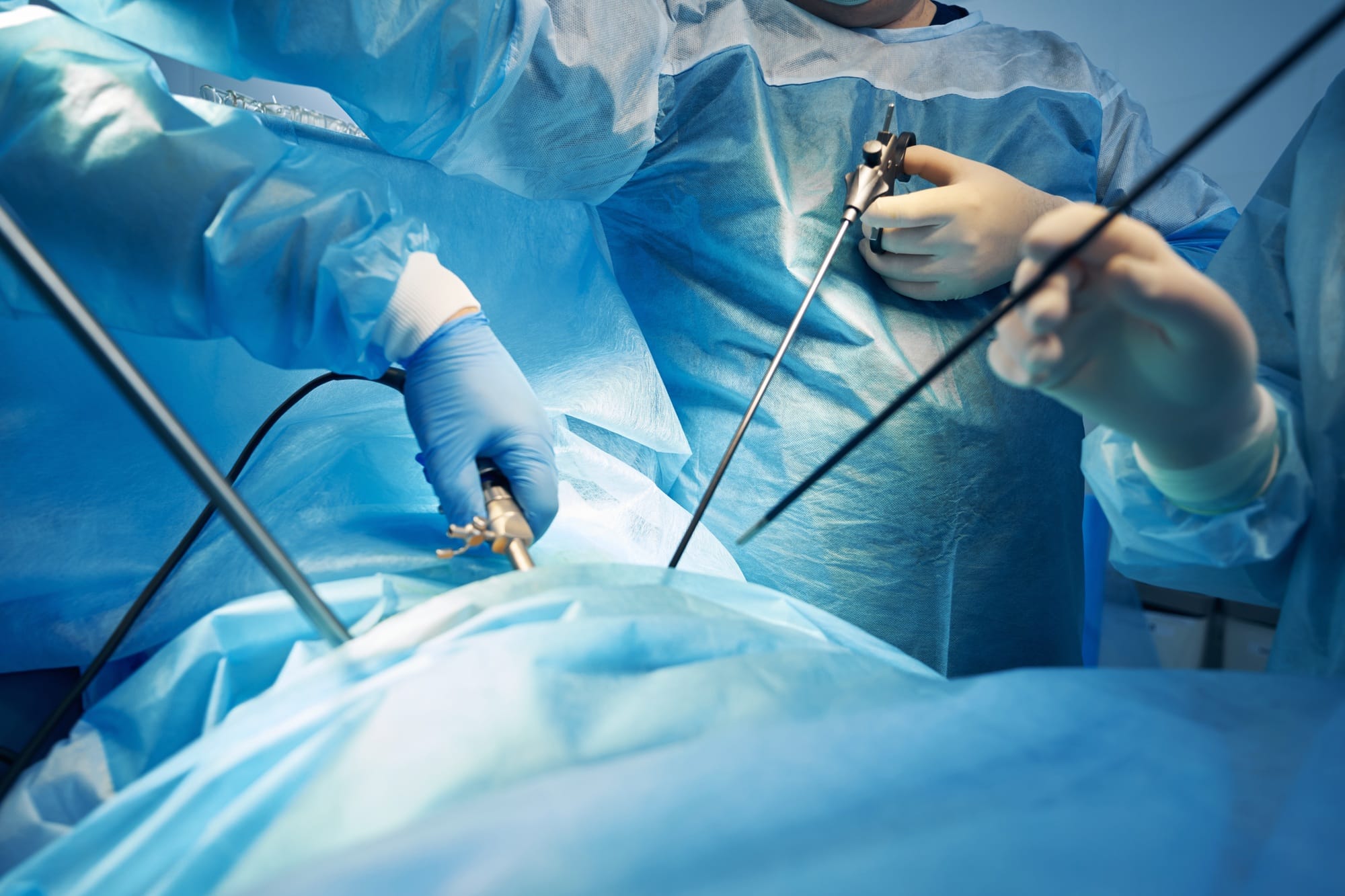 Surgeons working with laparoscopic instruments during operation